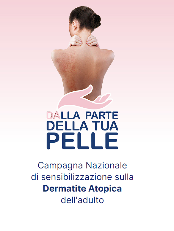 Toscana, Dermatite atopica: consulti gratuiti a Siena, Firenze e Pisa